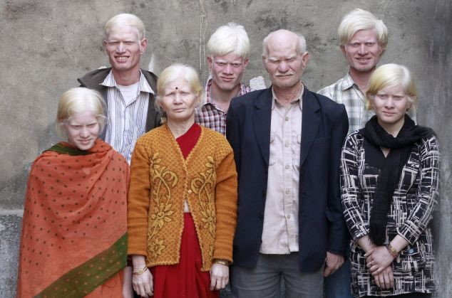 Read more about the article Conheça a maior família de albinos do mundo